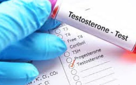 ماهو هرمون التستوستيرون نسبة هرمون التستوستيرون الطبيعية عند الرجال و النساء