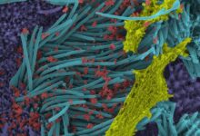 صورة فيروس كورونا حقيقية في جسم الانسان الرئة